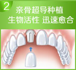 生物活性 迅速愈合